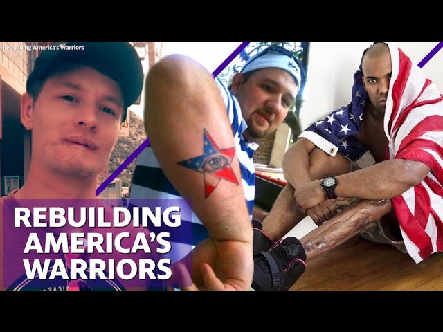 This nurse founded Rebuilding Americas Warriors to help wounded veterans get reconstructive surgery