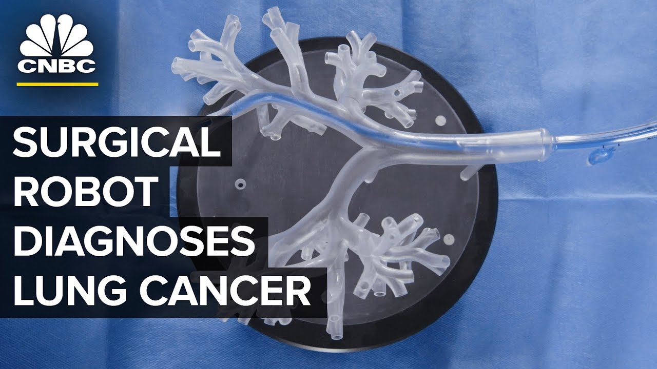 This Robot Can Diagnose Lung Cancer