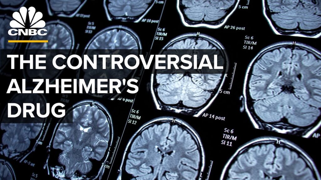 What’s The Controversy Behind Biogen’s Alzheimer’s Drug?